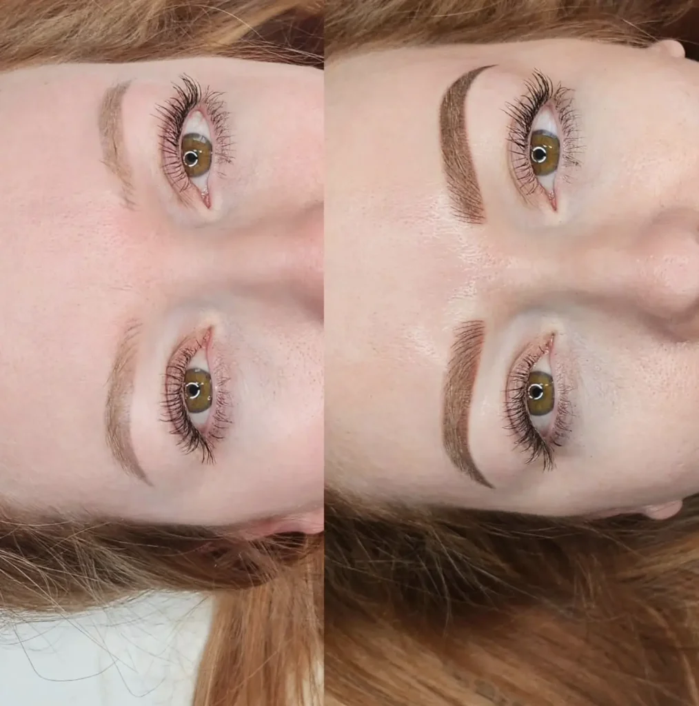 Eyebrow tattoo peeling
